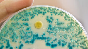 KI kann helfen antibiotikaresistente Bakterien zu erkennen